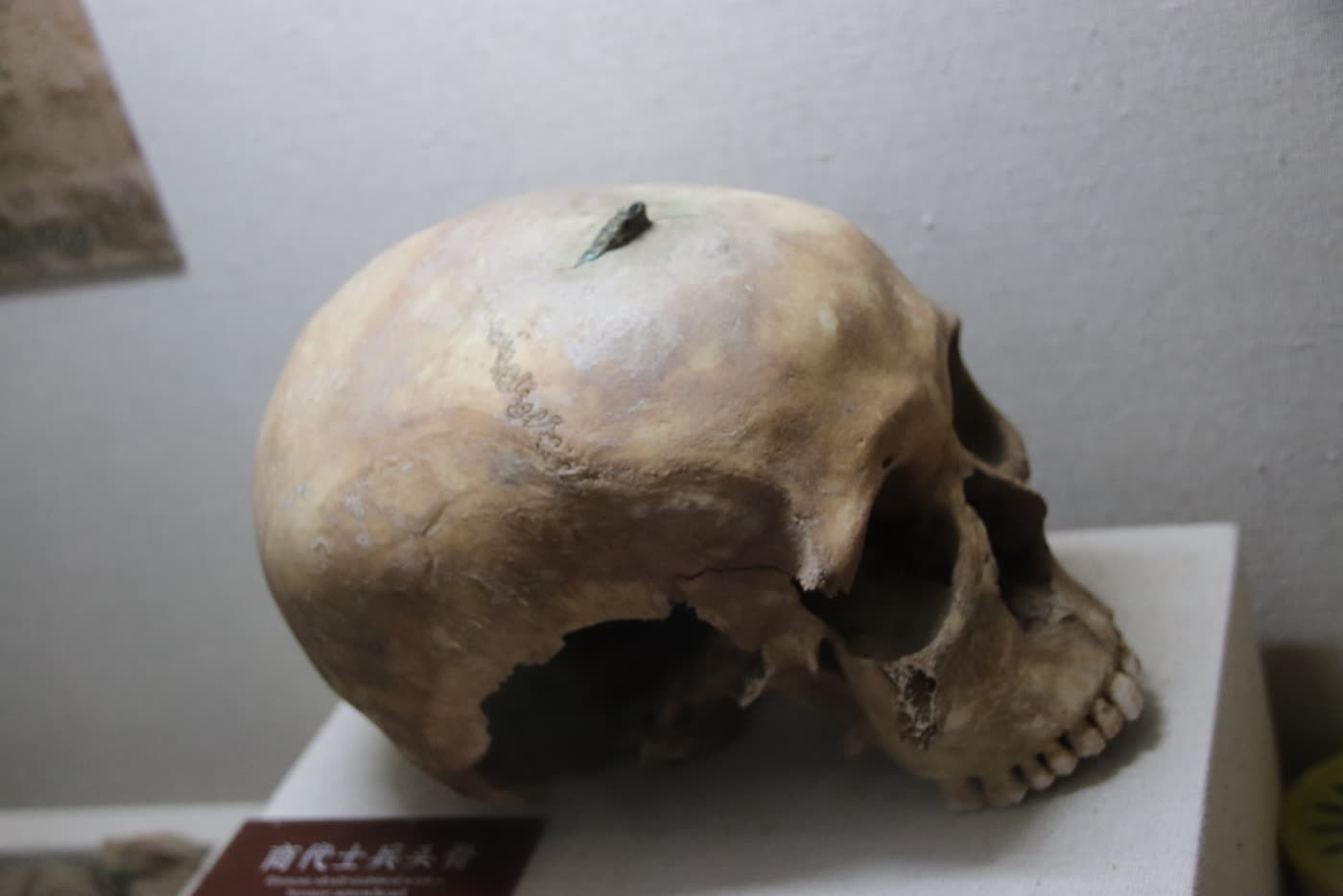嵌着铜镞的头骨